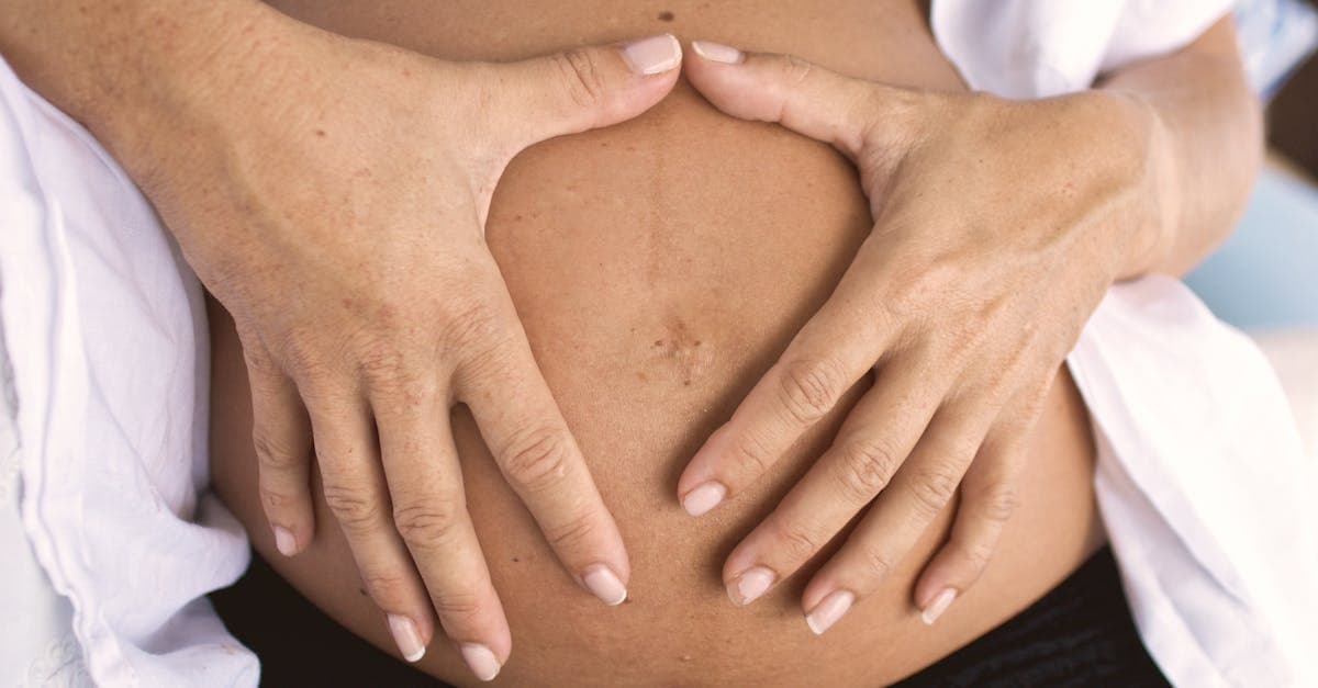 Cover Image for Belly Button Hernias Explained: Key Causes and Warning Signs