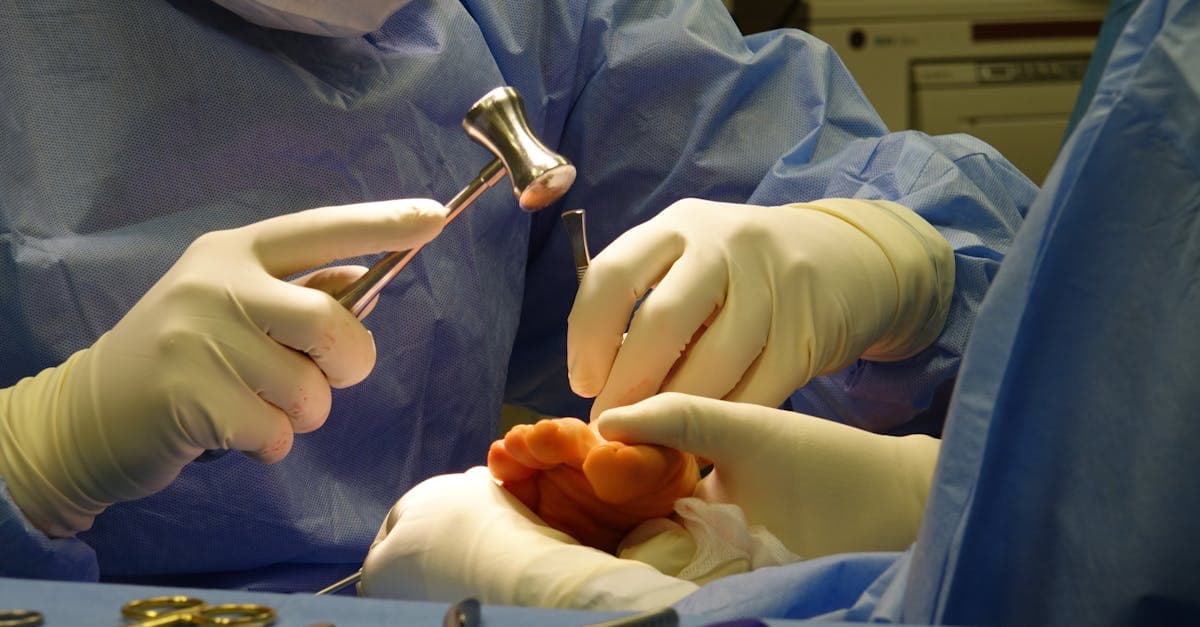 Cover Image for Gastric Sleeve Surgery Trends: What Patients Need Now